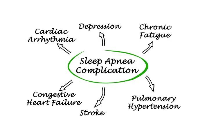 consequences of OSA, beacon hospital