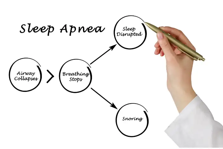 signs and symptoms, obstructive sleep apnea, beacon hospital