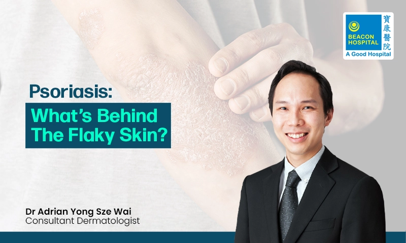 Dr Adrian Yong, Health Hub Blog, Psoriasis, Dermatologist, Beacon Hospital Doctor, Cancer Centre