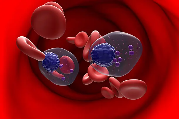 myeloma, beacon hospital. red blood cell, white blood cell, platelets, artery, 多发性骨髓瘤, Mieloma, Cancer Centre of Excellence