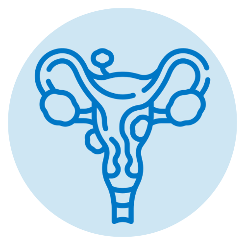 Uterine Sarcoma Icon, Beacon Hospital, Cancer Type